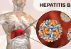 Things to know about taking treatment for hepatitis B