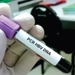 Hepatitis B DNA Testing