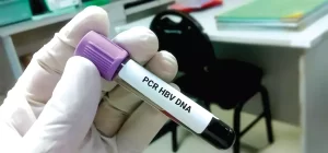 Hepatitis B DNA Testing