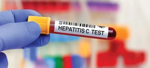 Free testing for hepatitis B and hepatitis C